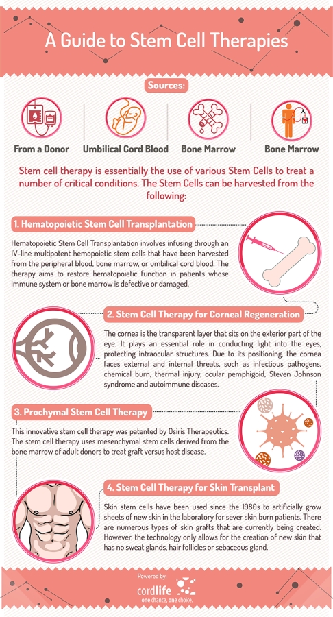 A Guide To Stem Cell Therapy Infographics